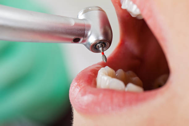 Best Emergency Treatment for Oral Infections in Rochester Hills, MI